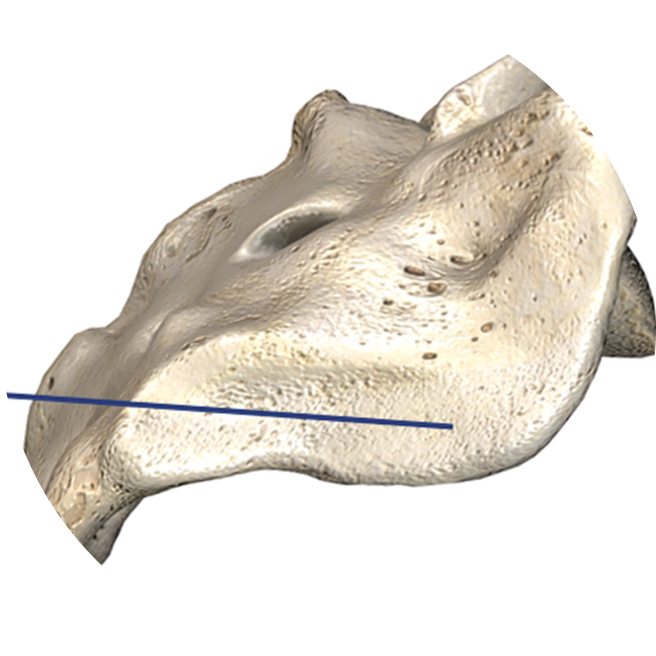 si joint 3d view