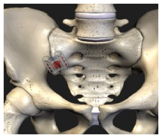 si joint 3d view